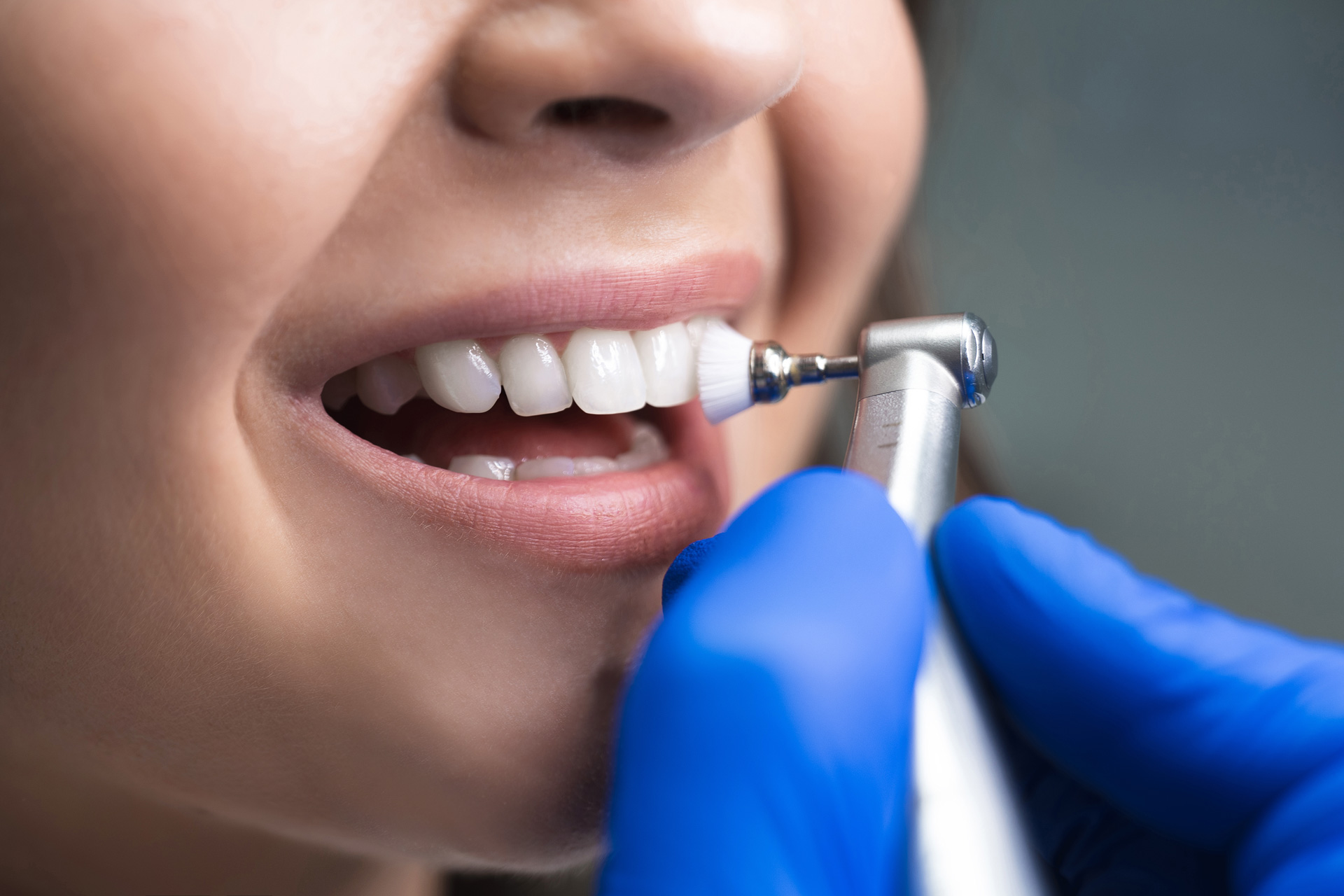 A person having their teeth cleaned with a dental tool by a professional dentist.