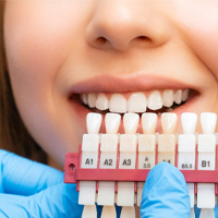 A person smiles while holding a veneer shade guide used for comparing teeth shades.